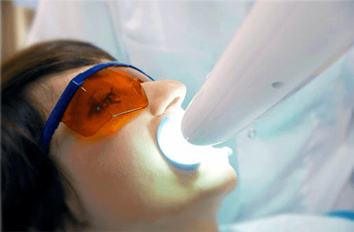 Understanding the Causes of Teeth Sensitivity Fylde