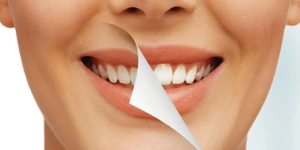 What Is Cosmetic Dentistry and How Can It Transform Your Smile Fylde