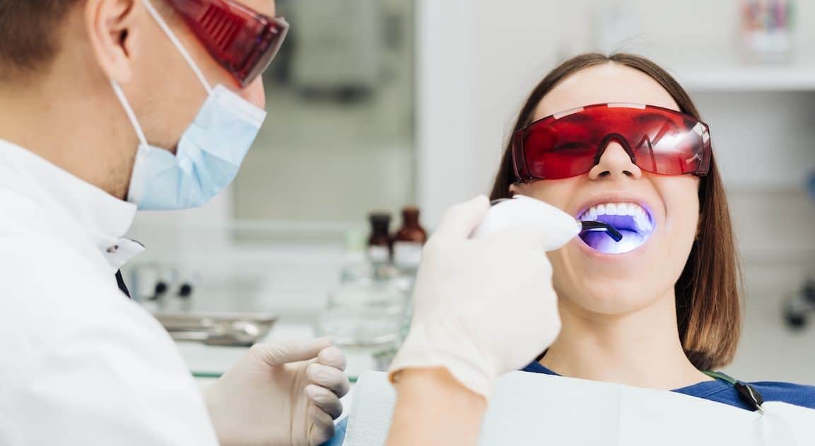 Do Dental Crowns Change Colour After Teeth Whitening Fylde?