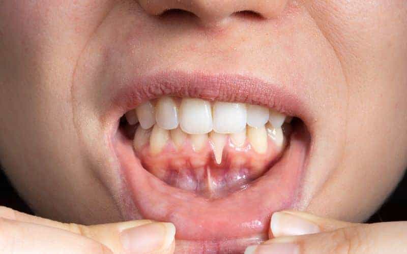 Final Thoughts: Building Lifelong Enamel Protection Habits Fylde