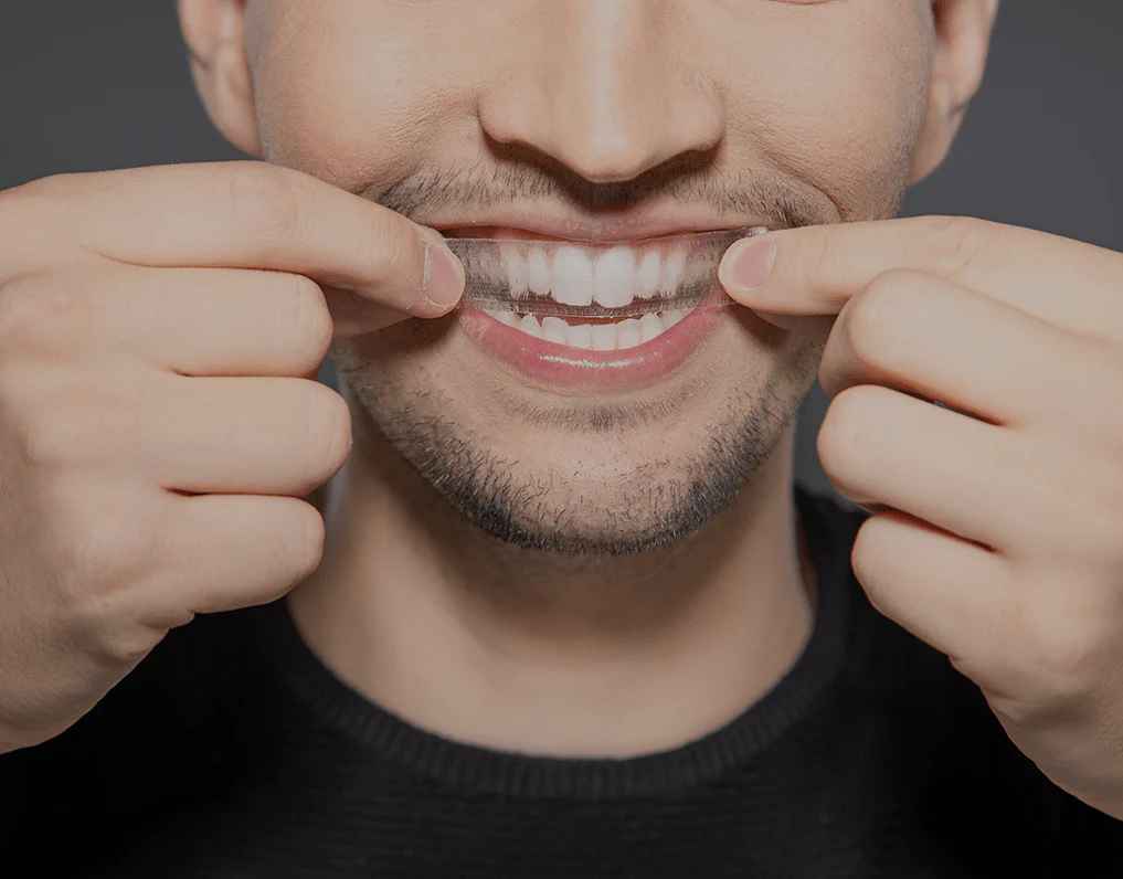 Can You Whiten Natural Teeth Without Harsh Chemicals Fylde?