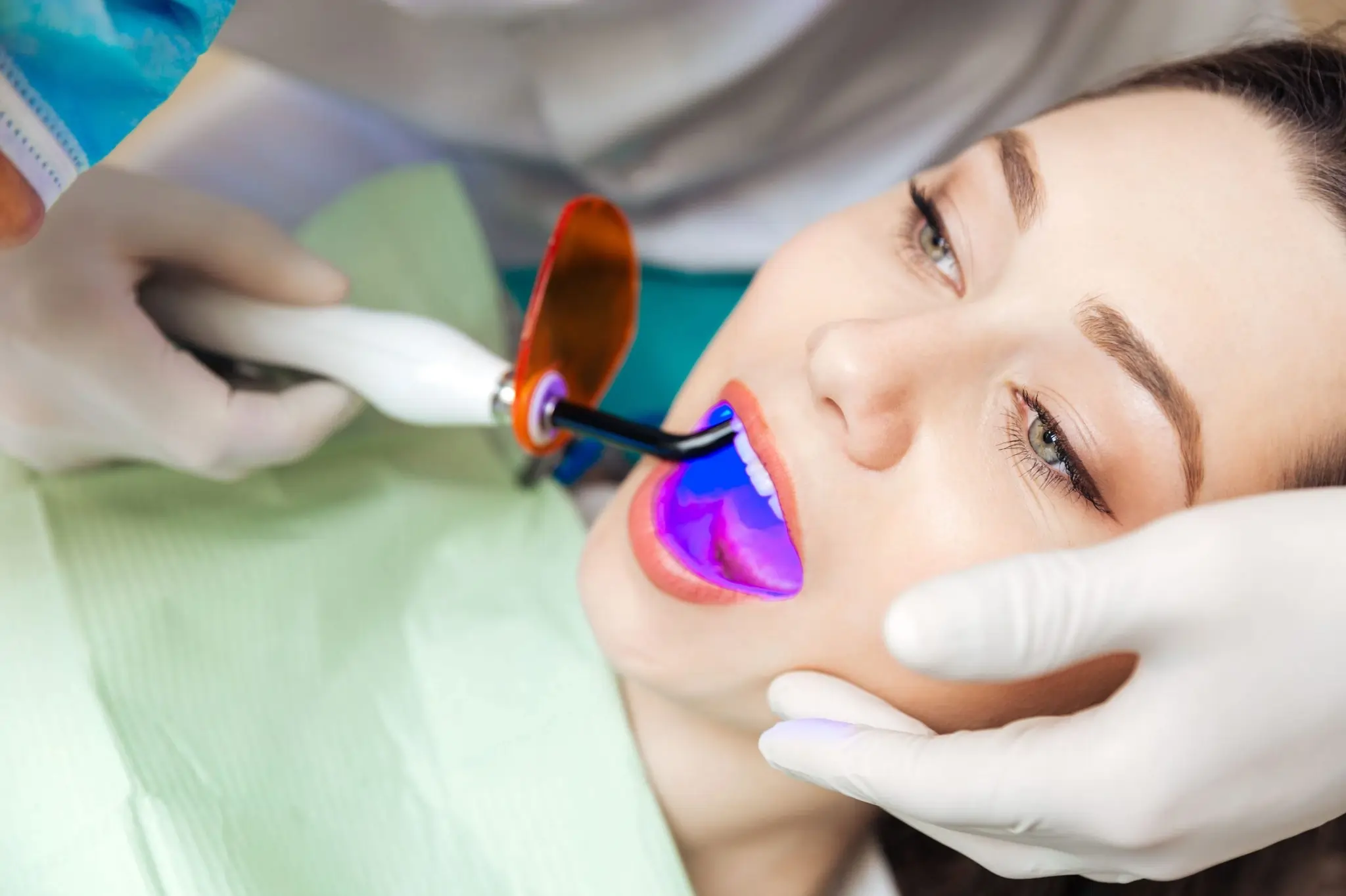 How Do You Choose the Right Teeth Whitening Fylde Option for Your Smile?