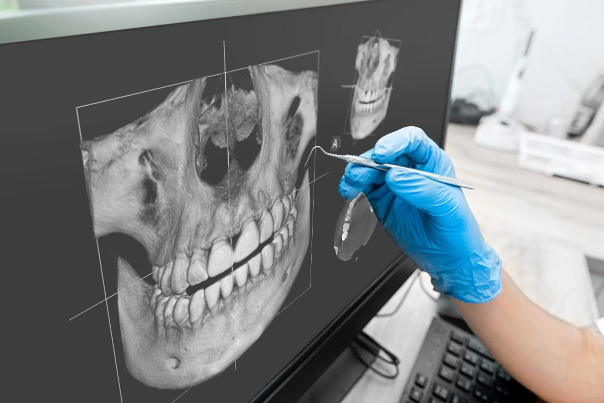 How Is AI Transforming Dental Treatment Planning Fylde?