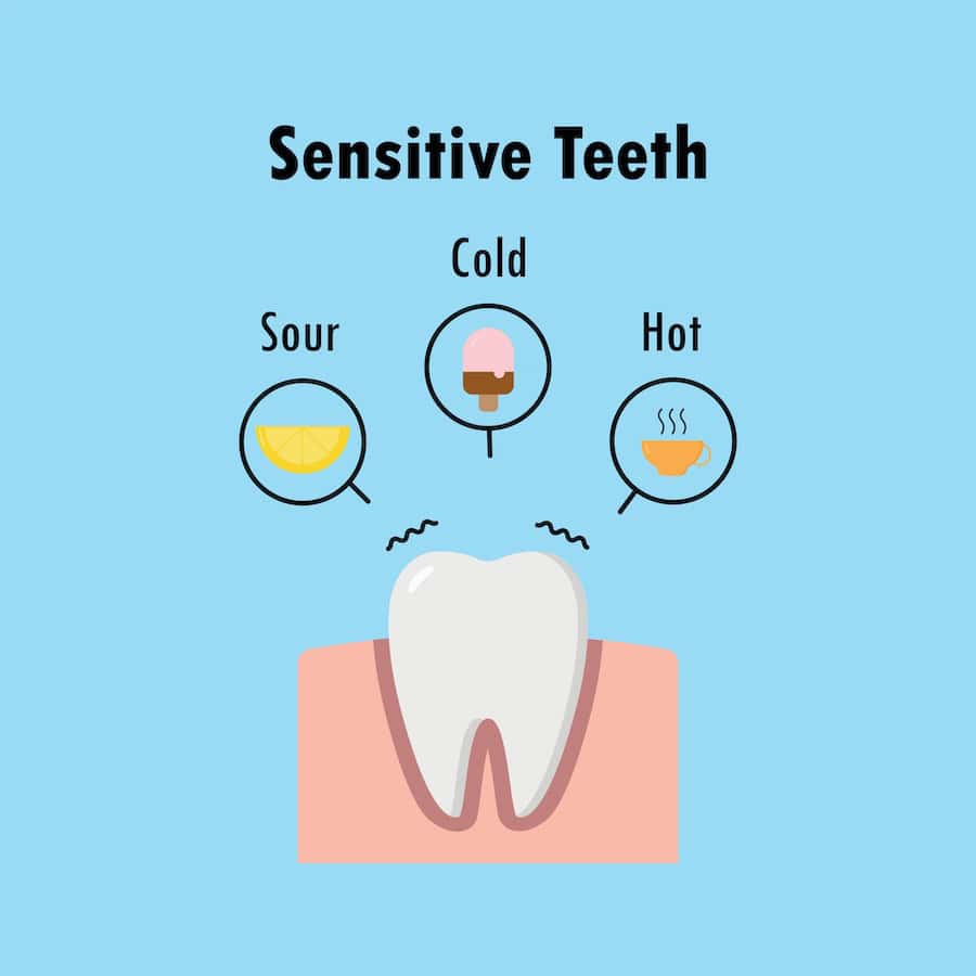 How Can You Tell If Your Teeth Are Becoming Sensitive Fylde?