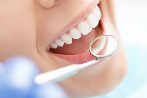The Science Behind Natural Whitening: Myth vs Reality Fylde