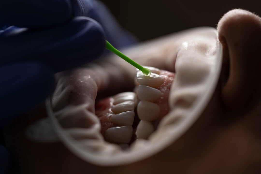 The Role of Saliva: Nature’s Defense System Fylde