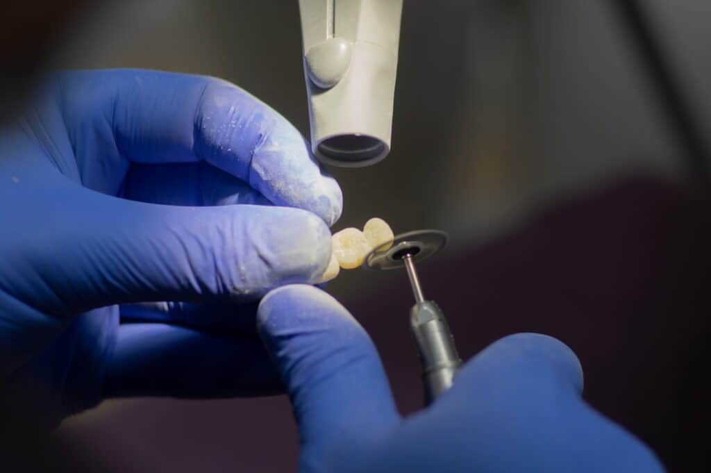 Customised Dental Solutions: Crowns, Aligners, and Implants Fylde