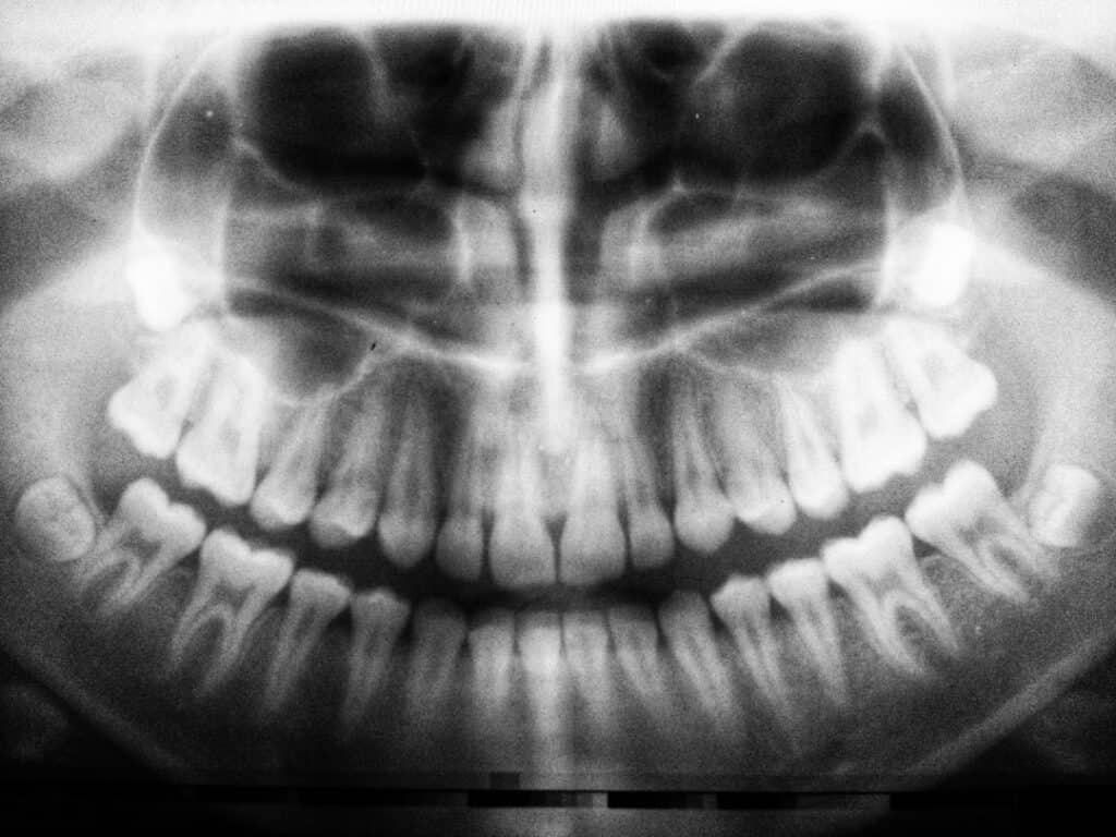 The Future of 3D Printing in Oral Healthcare Fylde